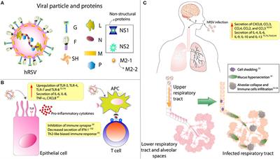 Contribution of Cytokines to Tissue Damage During Human Respiratory Syncytial Virus Infection